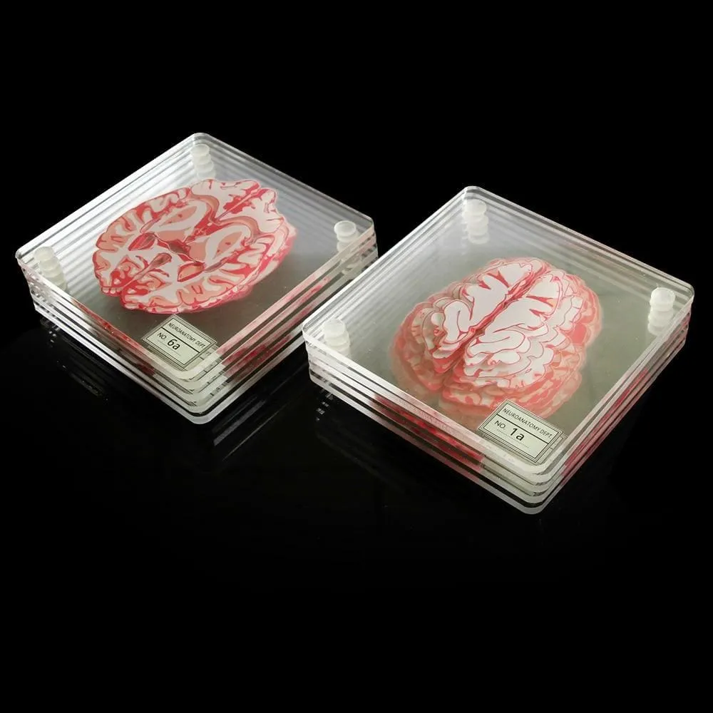 Brain Specimen Coasters Set