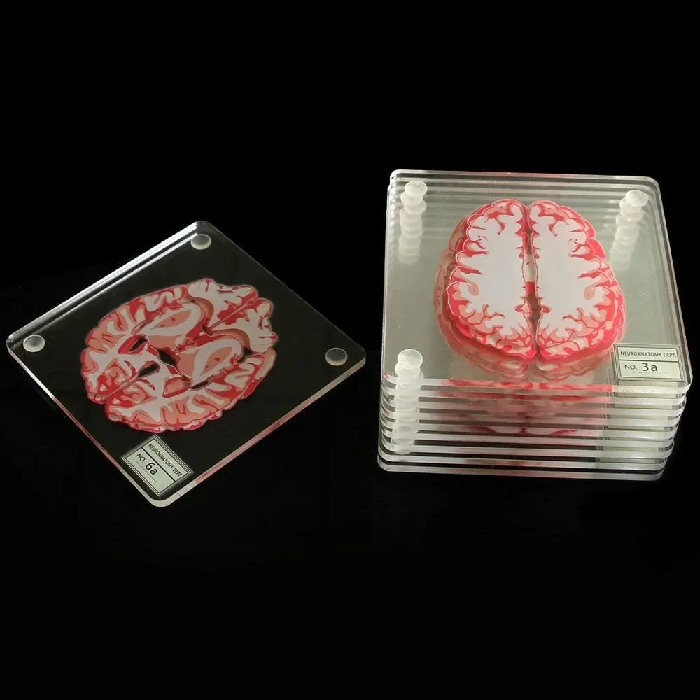 Brain Specimen Coasters Set
